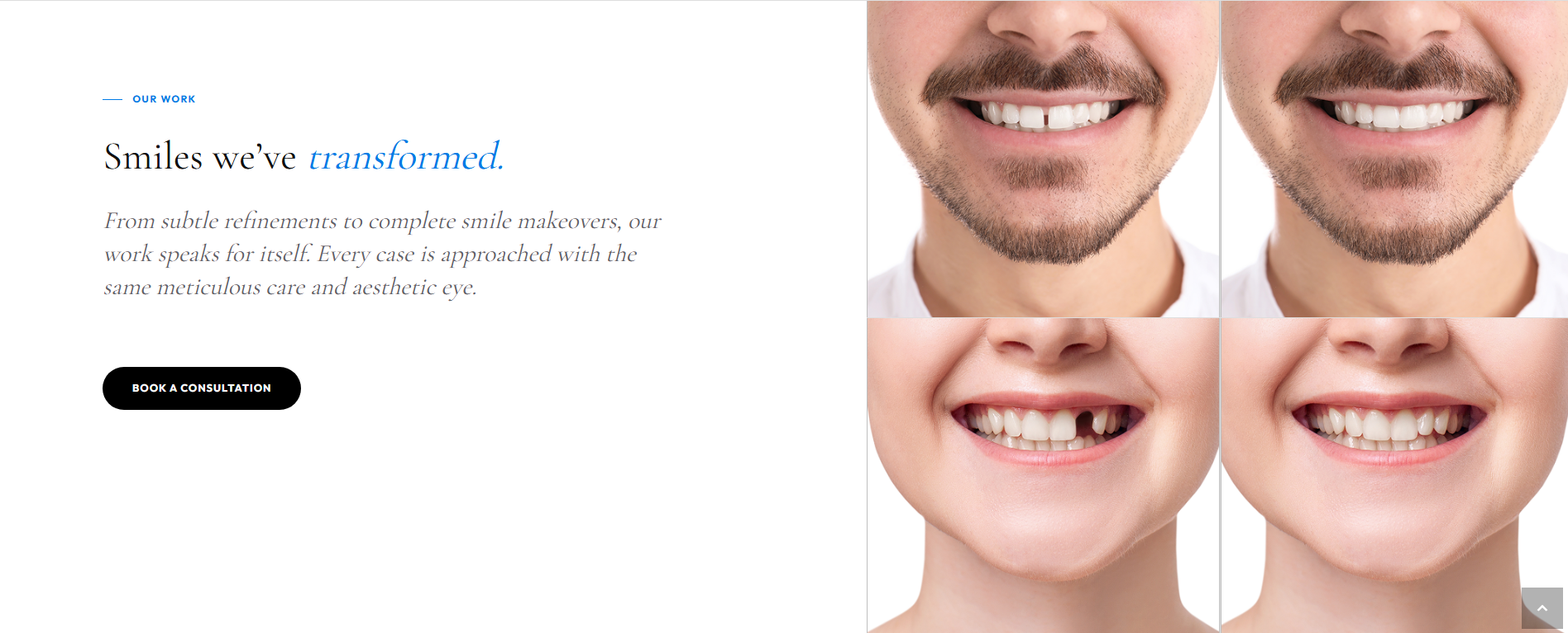 Solon Family Dental desktop smile transformation section with consultation call to action and before-and-after imagery.